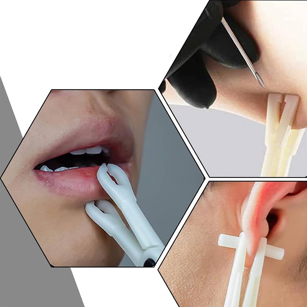 Disposable Forceps